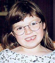 Elizabeth Peterson finally looses her first baby tooth